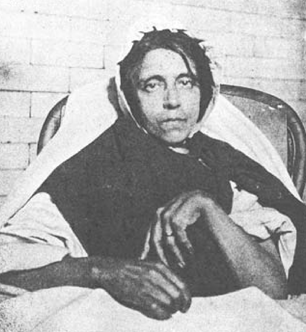 0720 | 早期产品责任保险